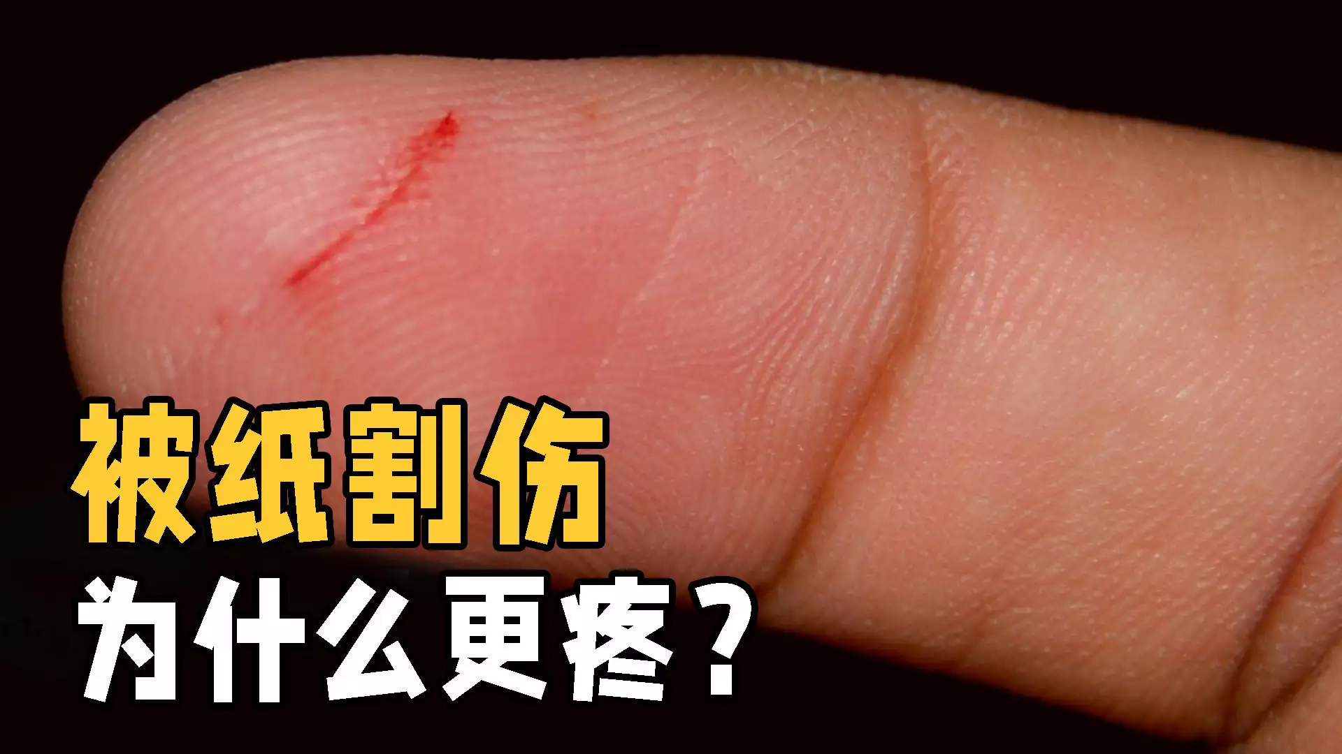 不可思议！为什么纸张划伤比刀子还疼？快来一探究竟！